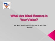 What Are Black Floaters in Your Vision? (1)