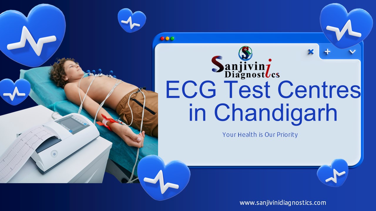 ECG Test Centers in Chandigarh - Sanjivini Diagnostics