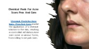 Chemical Peels For Acne Scars: Pros And Cons