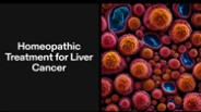 Liver Cancer Homeopathy Treatment