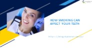 HOW SMOKING CAN AFFECT YOUR TEETH