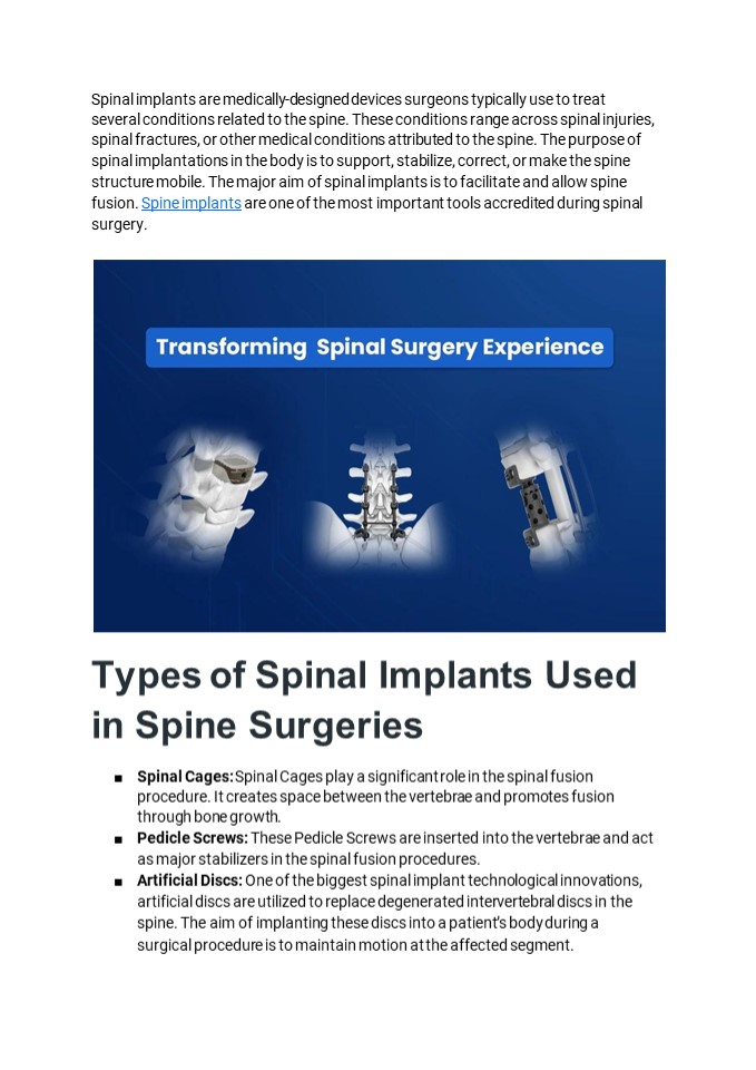 Spinal Implants: Transforming the Spinal Surgery Experience