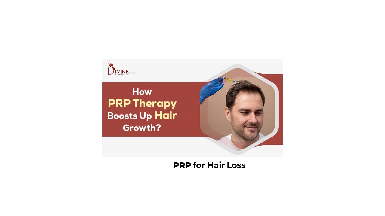 How does PRP Therapy work for Hair Loss?