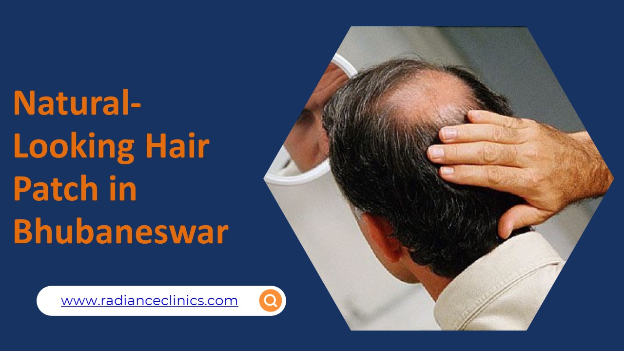 Natural-Looking Hair Patch in Bhubaneswar (1)