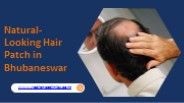 Natural-Looking Hair Patch in Bhubaneswar (1)