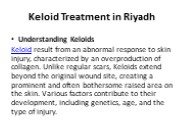Keloid Treatment in Riyadh