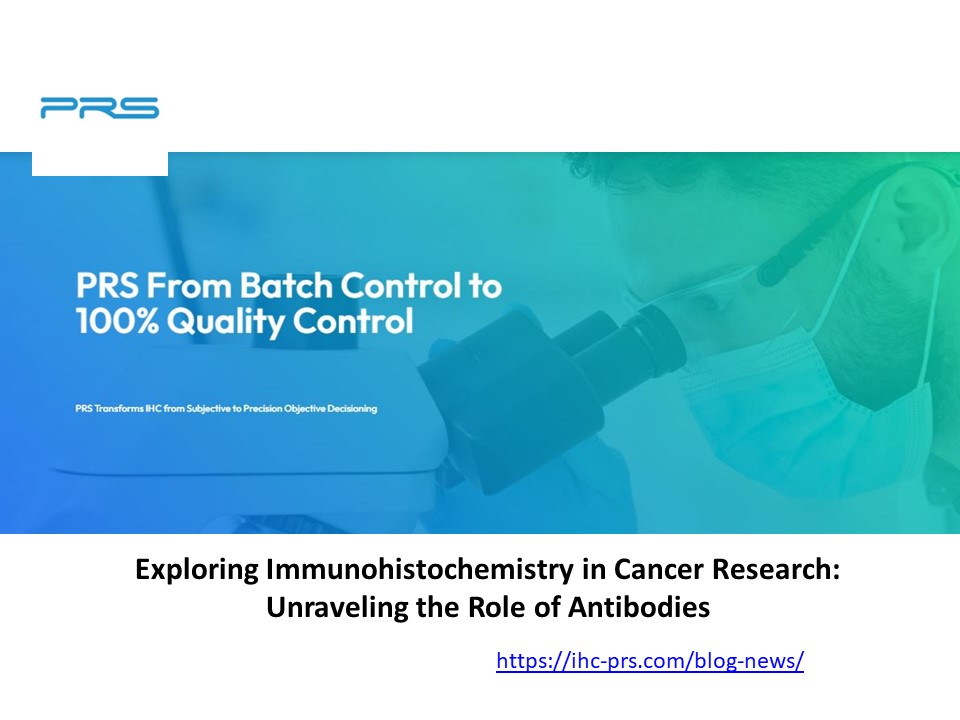 Exploring Immunohistochemistry in Cancer Research: Unraveling the Role of Antibodies