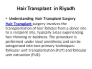 Hair Transplant in Riyadh