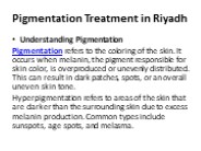 Pigmentation Treatment in Riyadh