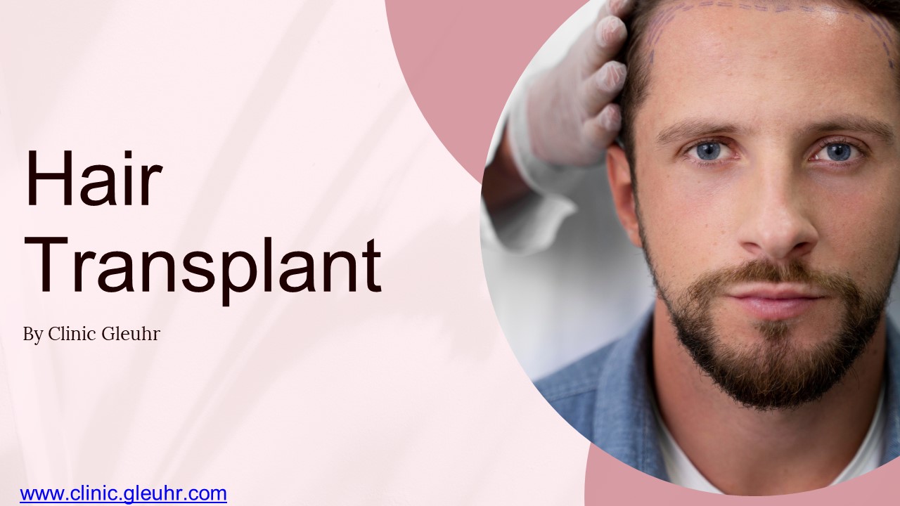 What is hair transplant?