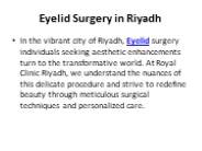 Eyelid Surgery