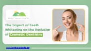 Role of Teeth Whitening in Cosmetic Dentistry Evolution