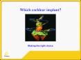 Which cochlear implant PowerPoint PPT Presentation