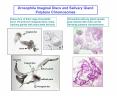 Drosophila Imaginal Discs and Salivary Gland Polytene Chromosomes PowerPoint PPT Presentation