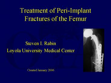 Treatment of PeriImplant Fractures of the Femur