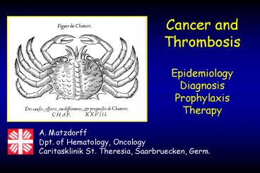 Cancer and Thrombosis Epidemiology Diagnosis Prophylaxis Therapy