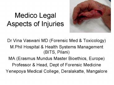 Medico Legal Aspects of Injuries