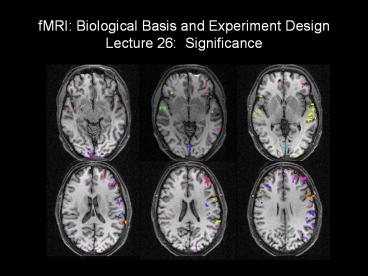 fMRI: Biological Basis and Experiment Design Lecture 26: Significance