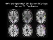fMRI: Biological Basis and Experiment Design Lecture 26: Significance