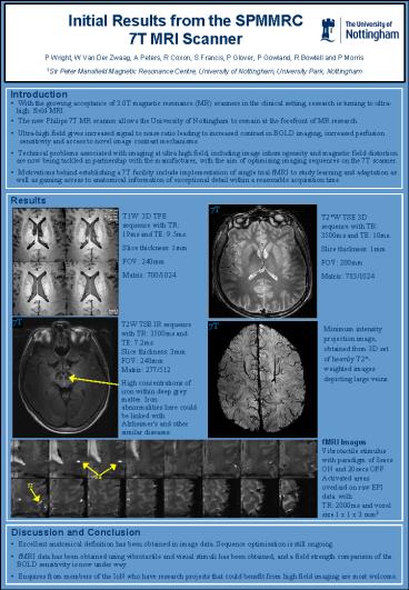 Initial Results from the SPMMRC 7T MRI Scanner