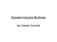 Epidermolysis Bullosa PowerPoint PPT Presentation