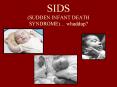 SIDS SUDDEN INFANT DEATH SYNDROME whaddup PowerPoint PPT Presentation