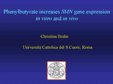 Distinguishing DMD from BMD