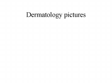 Dermatology pictures