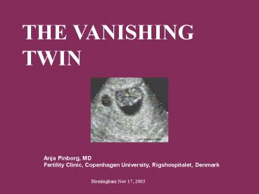 Tvillinger og Single Embryo Transfer