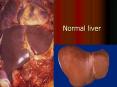 Normal liver PowerPoint PPT Presentation