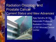 Radiation Oncology and Prostate Cancer Current Status and New Advances PowerPoint PPT Presentation