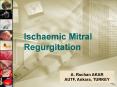Ischaemic Mitral PowerPoint PPT Presentation