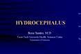 HYDROCEPHALUS PowerPoint PPT Presentation