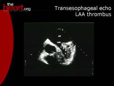 presentation player overlay