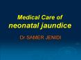 Medical Care of neonatal jaundice PowerPoint PPT Presentation