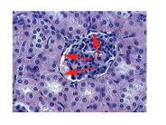 Simple Squamous - x-sect