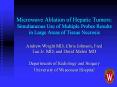 Microwave%20Ablation%20of%20Hepatic%20Tumors:%20Simultaneous%20Use%20of%20Multiple%20Probes%20Results%20in%20Large%20Areas%20of%20Tissue%20Necrosis PowerPoint PPT Presentation