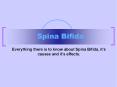 Spina Bifida PowerPoint PPT Presentation