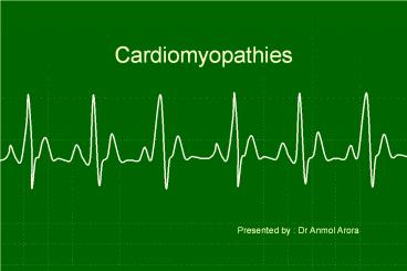 Cardiomyopathies