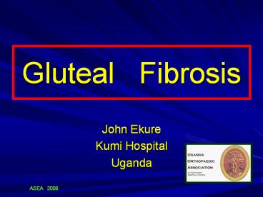 Gluteal  Fibrosis