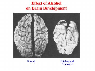 Prostacyclin Synthase Overexpression Prevents Mouse Lung Carcinogenesis