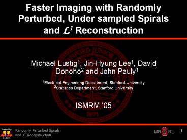 Faster Imaging with Randomly Perturbed, Under sampled Spirals and L1 Reconstruction