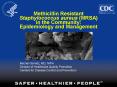 Methicillin Resistant Staphylococcus aureus (MRSA) in the Community: Epidemiology and Management PowerPoint PPT Presentation