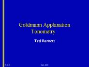 Goldmann Applanation Tonometry