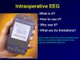 Intraoperative EEG PowerPoint PPT Presentation
