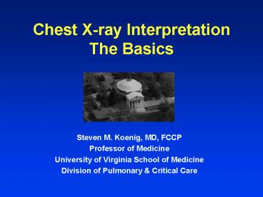 Chest Xray Interpretation The Basics