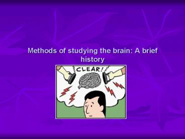 Methods of studying the brain: A brief history