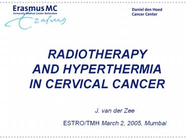 RADIOTHERAPY       AND HYPERTHERMIA     IN CERVICAL CANCER