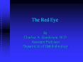 The Red Eye PowerPoint PPT Presentation
