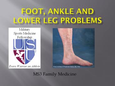 Foot, Ankle and Lower Leg Problems